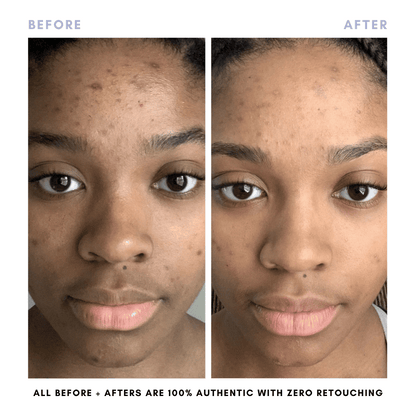 The Juicy Skin Special (+ FREE Rose Suds Cleanser) - Trending Wellness Store