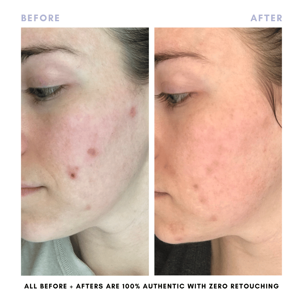 The Juicy Skin Special (+ FREE Rose Suds Cleanser) - Trending Wellness Store