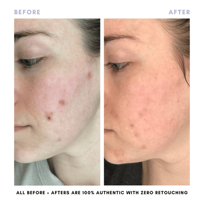 The Juicy Skin Special (+ FREE Rose Suds Cleanser) - Trending Wellness Store