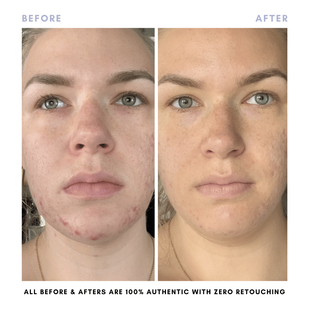 The Juicy Skin Special (+ FREE Rose Suds Cleanser) - Trending Wellness Store