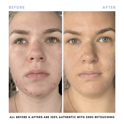 The Juicy Skin Special (+ FREE Rose Suds Cleanser) - Trending Wellness Store