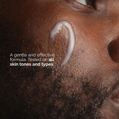 The Ordinary Niacinamide 5% Face & Body Emulsion - Trending Wellness Store