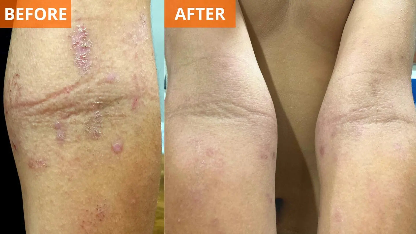 Moisturizing Skin Cream (Shopify Collective) - Trending Wellness Store