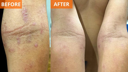 Moisturizing Skin Cream (Shopify Collective) - Trending Wellness Store