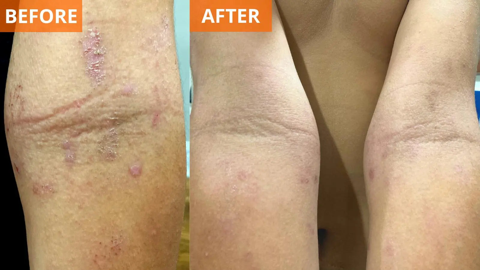 Moisturizing Body Lotion (Shopify Collective) - Trending Wellness Store