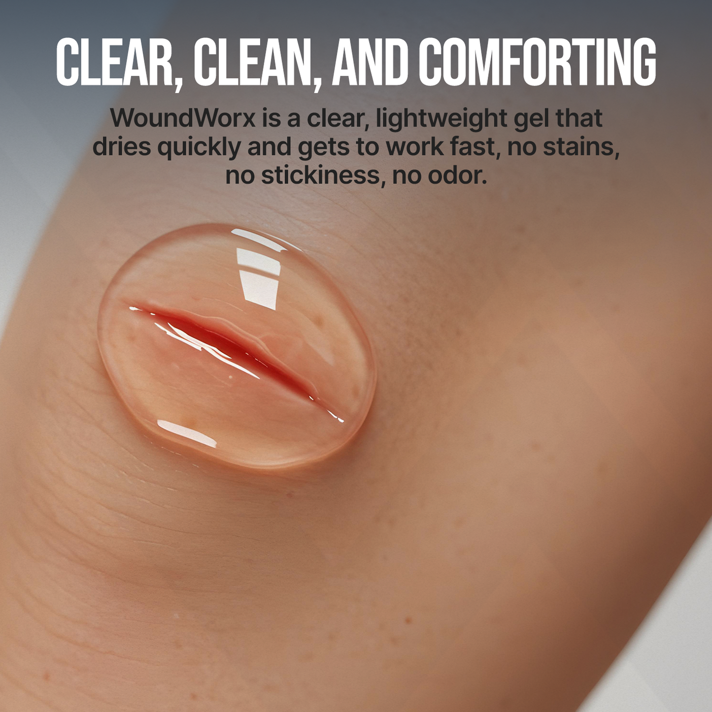 WoundWorx Wound Gel - Trending Wellness Store