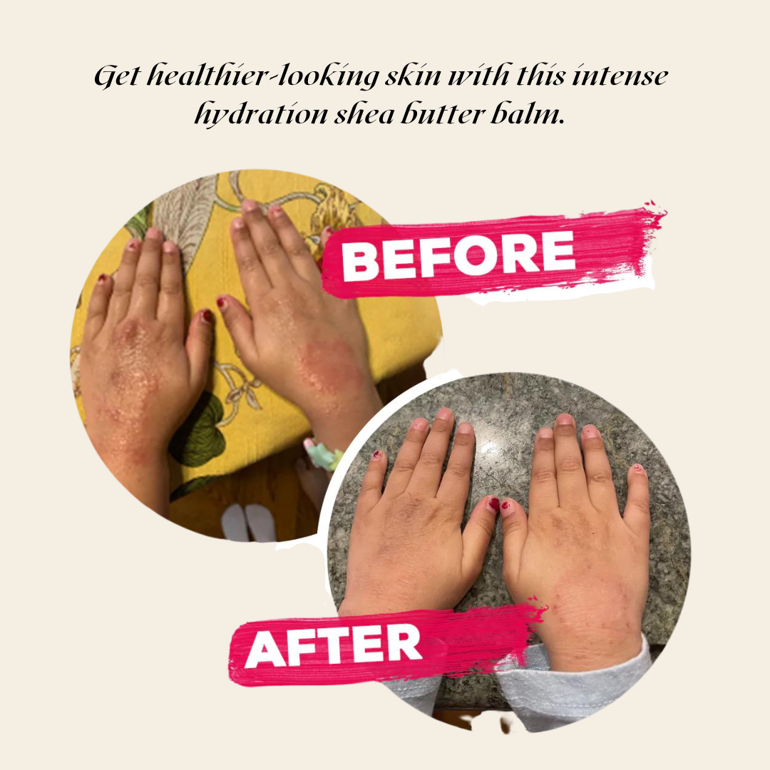 Intense Hydration Shea Butter Moisturizer for Dry Skin - Trending Wellness Store