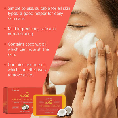 OceAura Acne Control Essential Oil Soap for Clear Skin & Oil Control - Trending Wellness Store