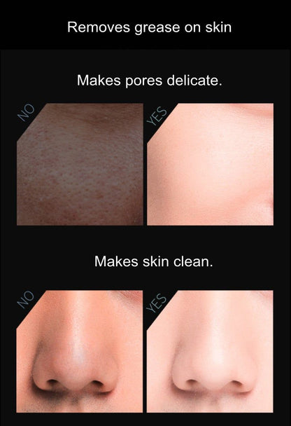 Volcanic Stone Oil-Absorbing Face Roller - Trending Wellness Store