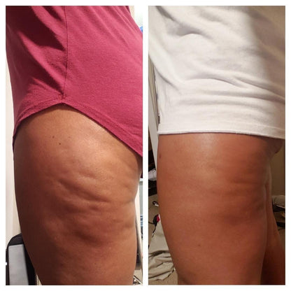 Anti-Cellulite Massage Oil - Trending Wellness Store