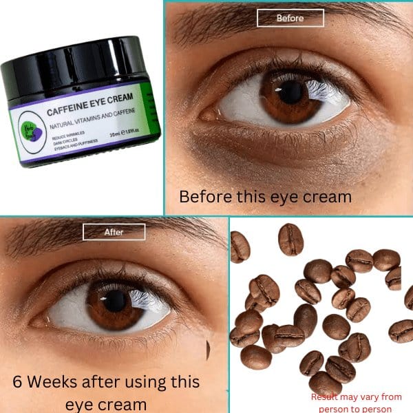 Khichi Beauty Caffeine Eye Cream - Trending Wellness Store
