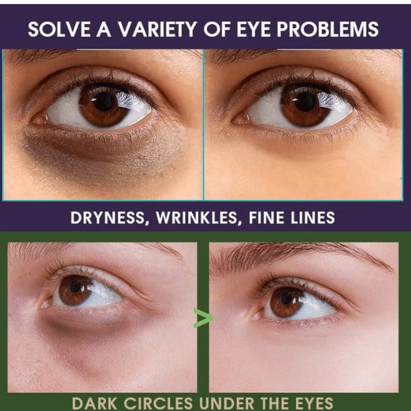 Khichi Beauty Supreme Age Renewal Anti-Aging Eye Cream - Trending Wellness Store