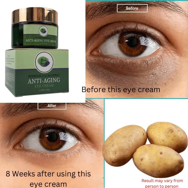 Khichi Beauty Supreme Age Renewal Anti-Aging Eye Cream - Trending Wellness Store