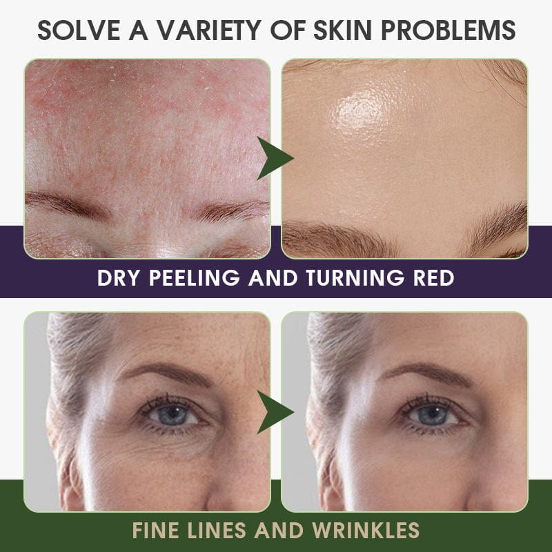 Khichi Beauty Supreme Age Renewal Anti-Aging Facial Toner - Trending Wellness Store