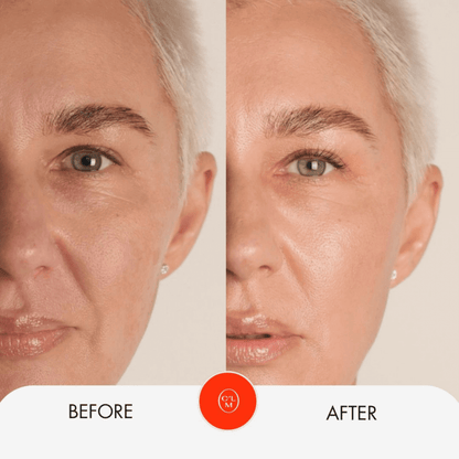 Moisturizing Facial Treatment Mask - Trending Wellness Store