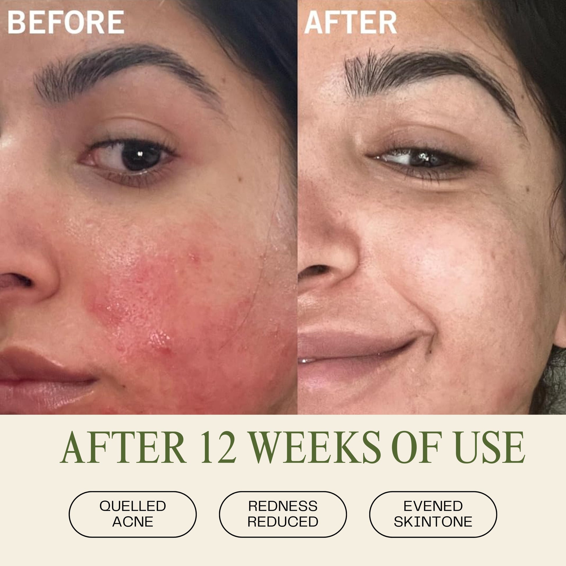 Pineapple & Rosehip Vitamin C Serum - Trending Wellness Store